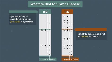 elisa test lyme|positive lyme negative western blot.